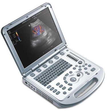 Chiropractic Greenbelt MD Muscuoloskeletal Ultrasound Monitor